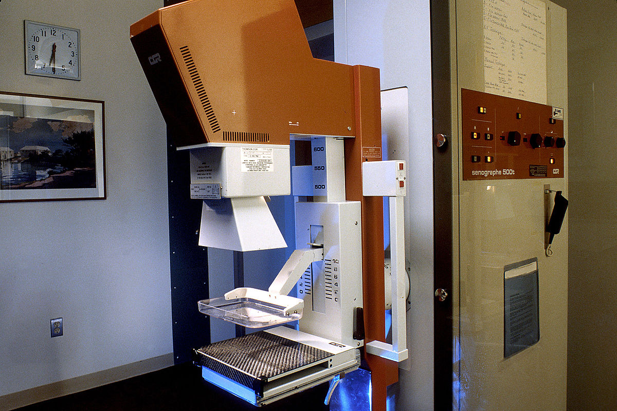 Screening Mammogram